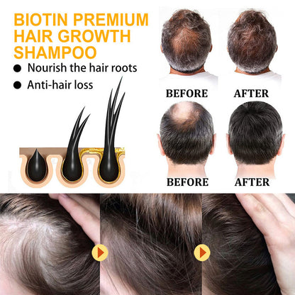 Biotin Anti-hair Loss Anti-dandruff Oil Control Nourishing Shampoo